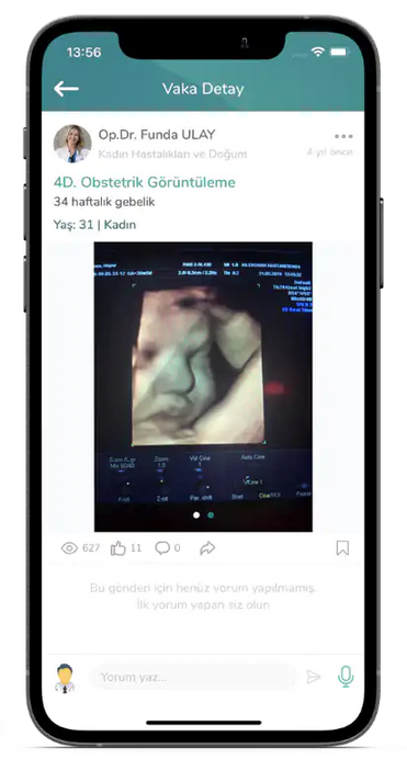 Operatör Doktor Funda Alay'ın Medklik'te 4D Obstetrik Görüntüleme Konulu gönderisi