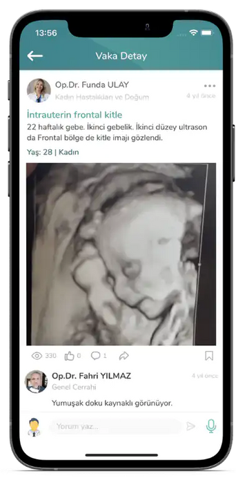 Operatör Doktor Funda Alay'ın, Medklikte İntrauterin Frontal Kitle konulu gönderisi