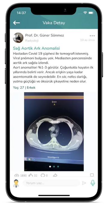 Prof. Dr. Güner Sönmez'in Medklik'te Sağ Aortik Ark Anomalisi başlıklı vaka paylaşımı
